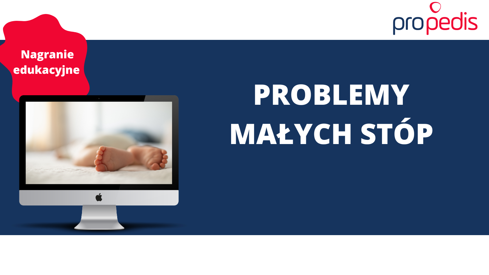 Problemy małych stóp