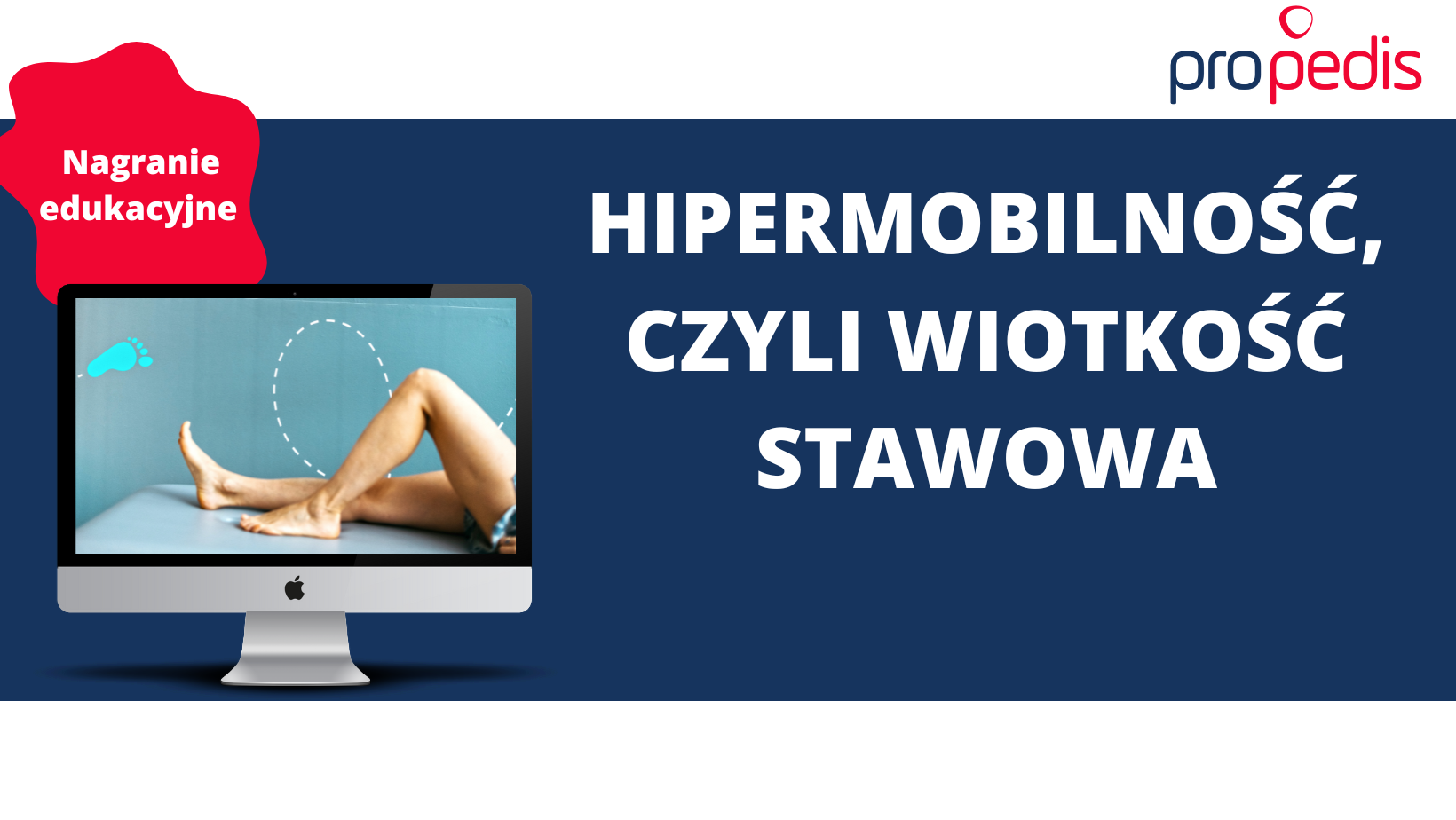 Hipermobilność, czyli wiotkość stawowa