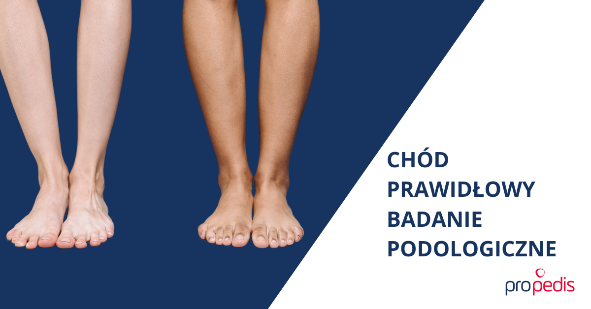 ORTOPODOLOGIA – CHÓD PRAWIDŁOWY & BADANIE PODOLOGICZNE