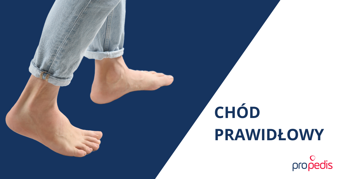 ORTOPODOLOGIA – CHÓD PRAWIDŁOWY